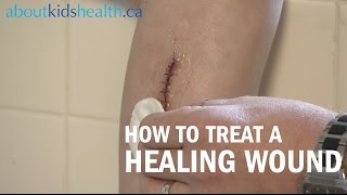 How to care for a healing wound