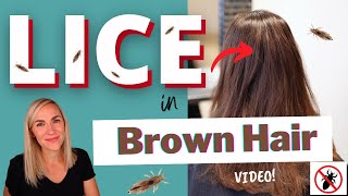 Lice in Brown Hair