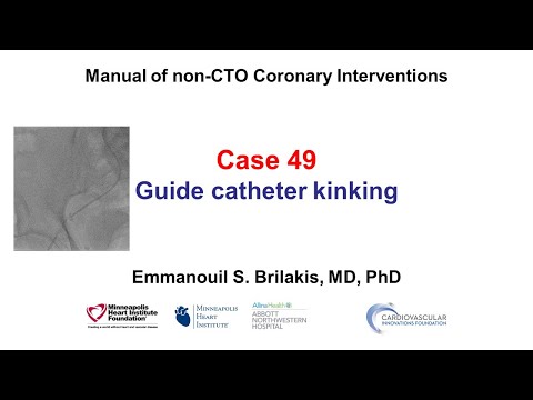 Case 49: PCI Manual - Guide catheter kinking