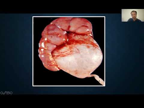 Congenital hydronephrosis part 1 أ.د أشرف سعد أستاذ المسالك جامعة اسكندرية