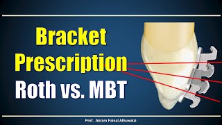 Using Roth and  MBT brackets