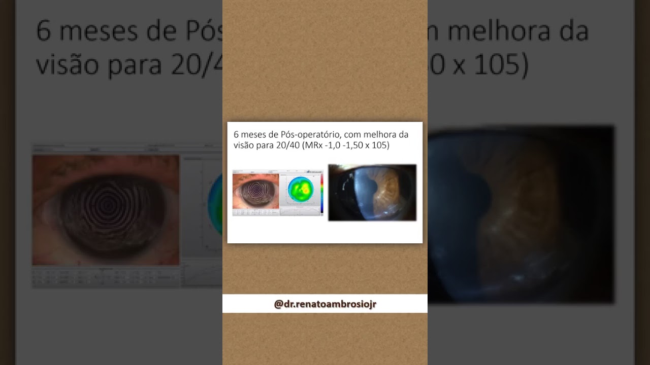 Sebastiana Barbosa – Depoimento