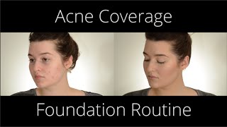 Acne Coverage Foundation Routine