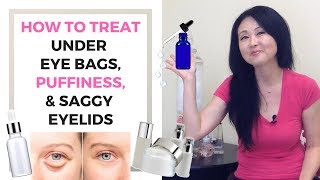 How to Treat Under Eye Bags, Puffiness, and Saggy Eyelids
