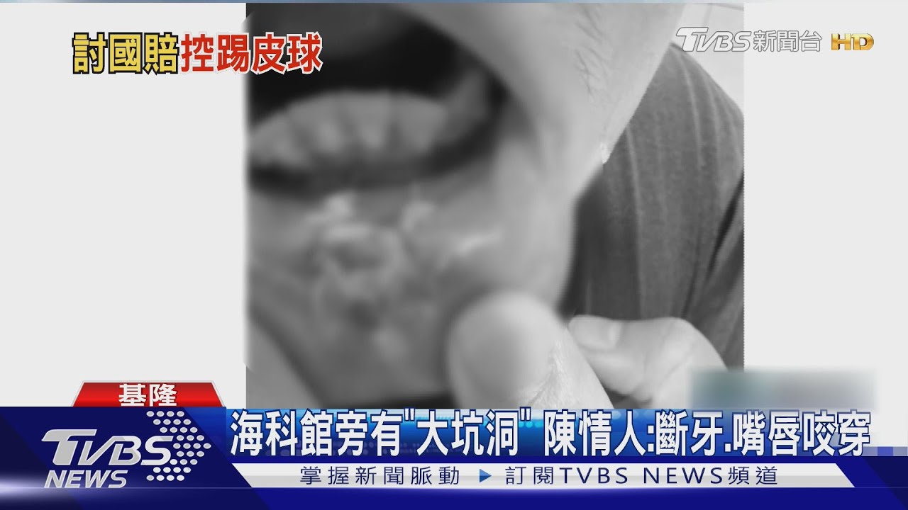 摔斷牙籲請國賠! 海科館、國產署「互踢球」