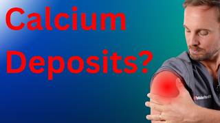 Calcific Tendonitis Shoulder Pain: Treatments Without Surgery