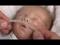 Medin Nuflow Nasal Cannulas Instructions For Use