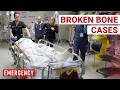 The Worst Fractures Ever Seen In ER