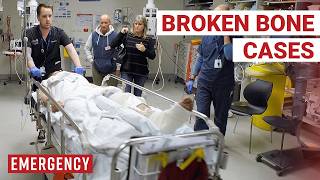 Download lagu The Worst Fractures Ever Seen In ER! mp3