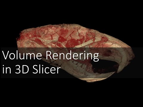 Volume Rendering in 3D Slicer | Introduction to Digital Preparation Video 9