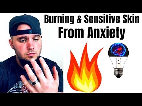 BURNING SENSATIONS & SENSITIVE SKIN FROM ANXIETY (PAINFUL SYMPTOM!)