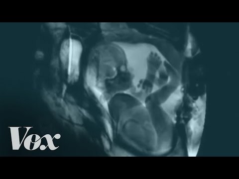 So This is What Sex in an MRI Looks Like...In Case You're Wondering