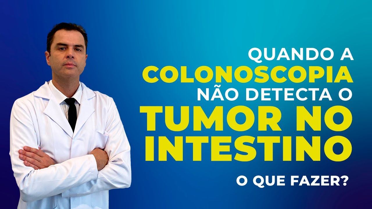 Colonoscopia FALHOU na detecção do Tumor Intestinal. Por quê? Dr. Fernando Lemos - Planeta Intestino