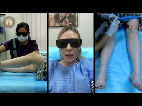 Laser Hair Removal at Elite Plastic & Cosmetic Surgery Group in Dubai