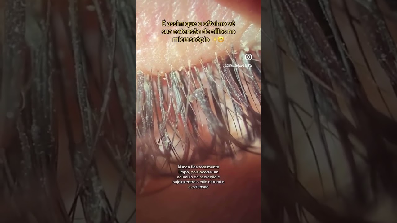 A limpeza dos cílios garante uma boa saúde ocular.