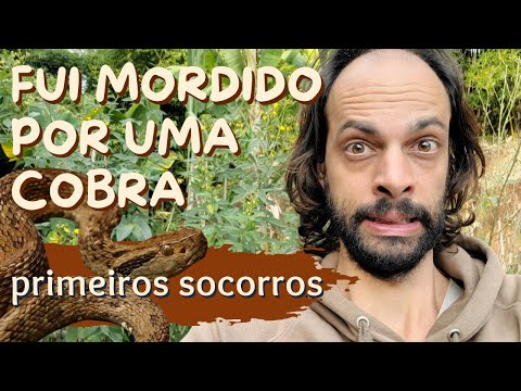 Picada de Cobra O que Fazer e Não Fazer