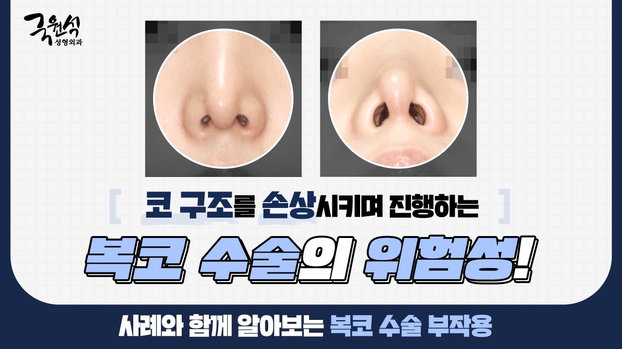 #복코수술 부작용 및 해결 방법! 그에 대한 실제사례, 같이 살펴봐요!