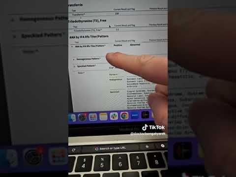 CASE STUDY! 62 female, joint pain, sore all over, constant inflammation, fatigue, no drive