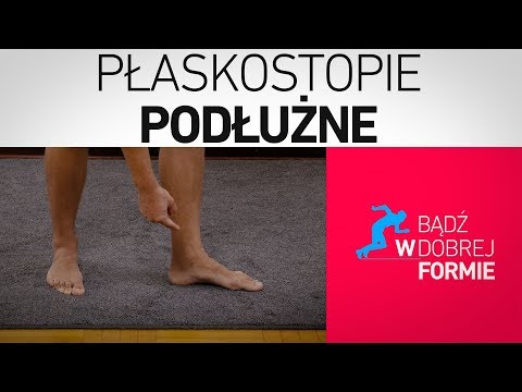 Jak leczyć kość na kciuk na nogi Koślawy jest to, co choroba