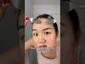 How To Pop Your Pimple Correctly 🫣 Acne Skincare Clearskin