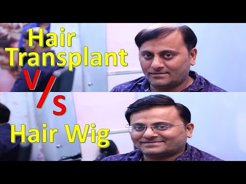 Veronica Hair Replacement Solution - Service Provider of Hair Patch Wigs &  Ladies Hair Extension from New Delhi