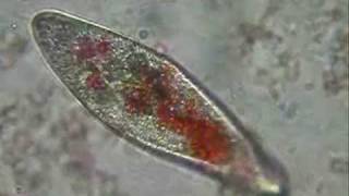 Paramecium eating pigmented yeast
