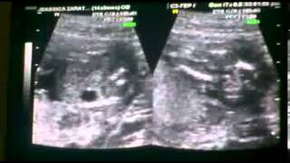 hubiera dado todo c kan ultramp4