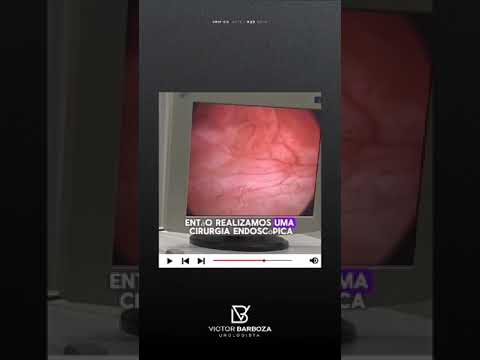 Victor Gomes Barboza-27