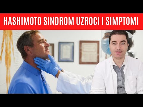 Hashimoto sindrom - uzroci i simptomi bolesti