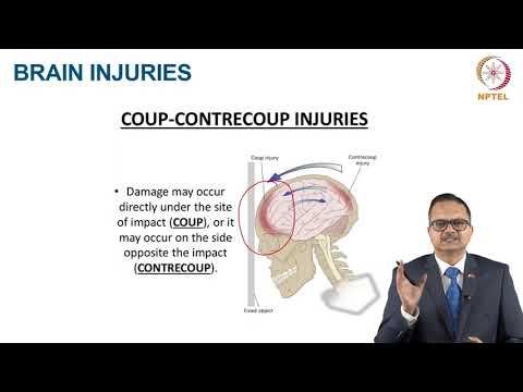 Concussion in Sports thumbnail