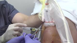 Video 3