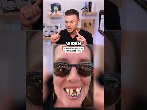 How Braces Completely CHANGED Her Life! 😮🦷