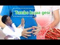 Fahamu Nini Kinapelekea Tumbo Kujaa Gesi