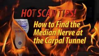 Hot Tip-How to Find the Median Nerve at the Carpal Tunnel