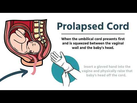 Pregnancy & Delivery Emergencies in EMS