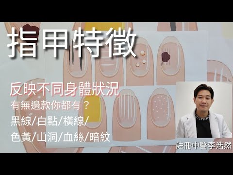 腳指甲 橫紋