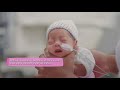Premature Baby Nutrition And Feeding