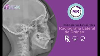 Rx Lateral de Cráneo