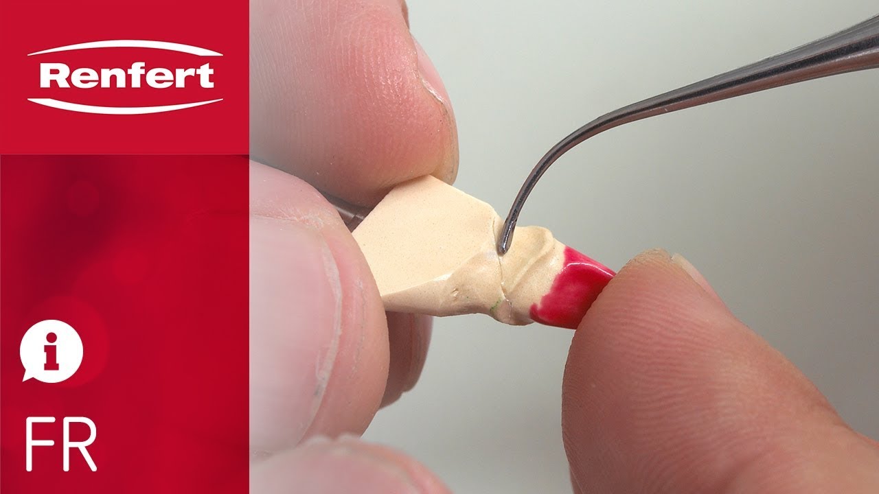 Vidéo Renfert colle instantanée et produits pour plâtre aperçu