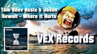 Tom Reev Assix & Jason Gewalt - Where It Hurts VEX'records Nocopyright