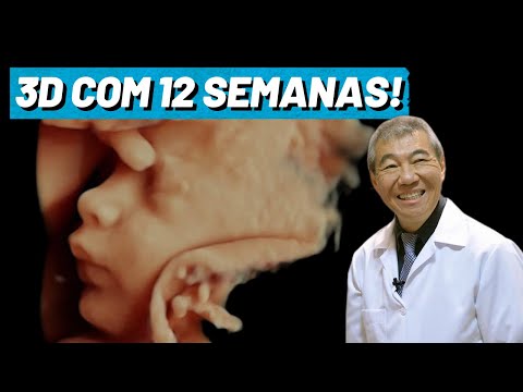 ULTRASSOM 3D COM 12 SEMANAS!