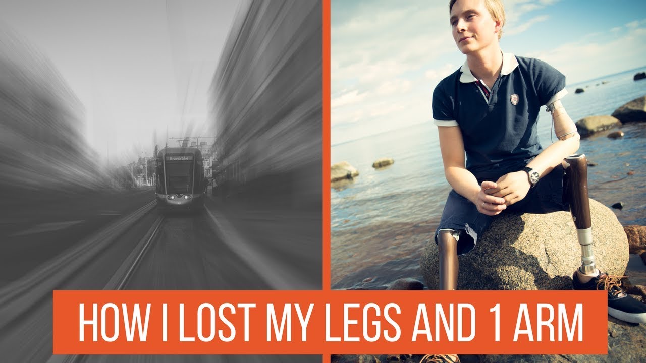 The Accident - What happened when I became amputated