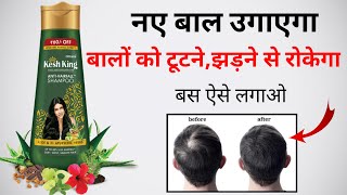 Kesh King Shampoo Review 2022 | kesh king shampoo kaise use kare