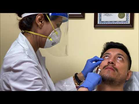 4D Under Eye Lift to treat dark circles under eyes & contour cheeks