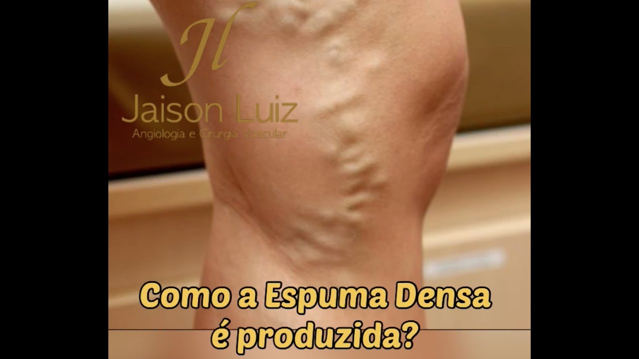 Jaison Luiz Argenta-9