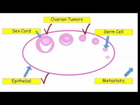 12DaysinMarch, Ovarian Tumors for USMLE Step One