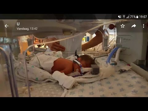 PREMATURE BABY  (our story) 29 weeks to 10 months(video and pictures