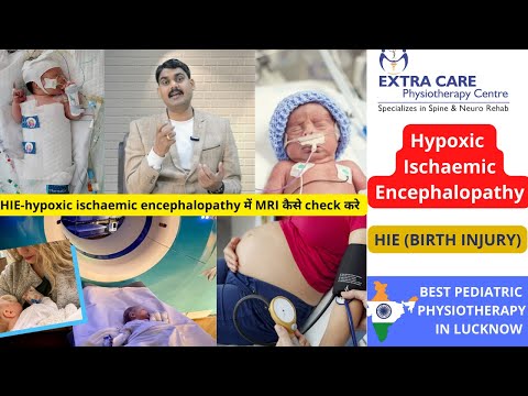 Hypoxic Ischaemic Encephalopathy | HIE in Babies| Birth Injury | Pediatric Physiotherapy in Lucknow