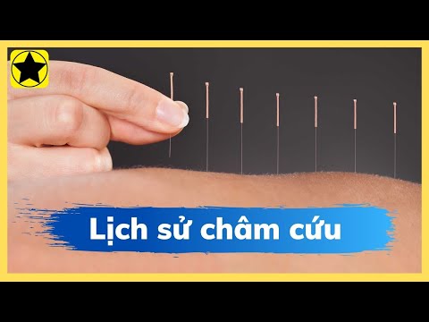 LỊCH SỬ CHÂM CỨU