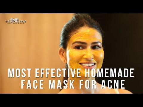 Most Effective Homemade Face Mask for Acne | How to Get Rid Of Acne & Acne Scars